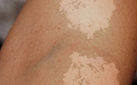 img_content_helle_flecken_480x300